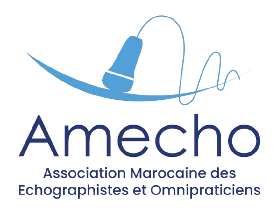 AMECHO
